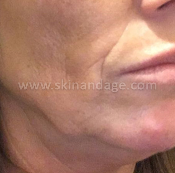 Image is not available