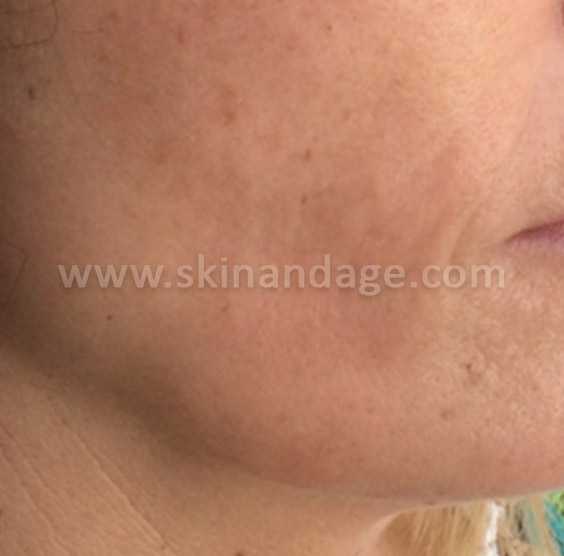 Image is not available