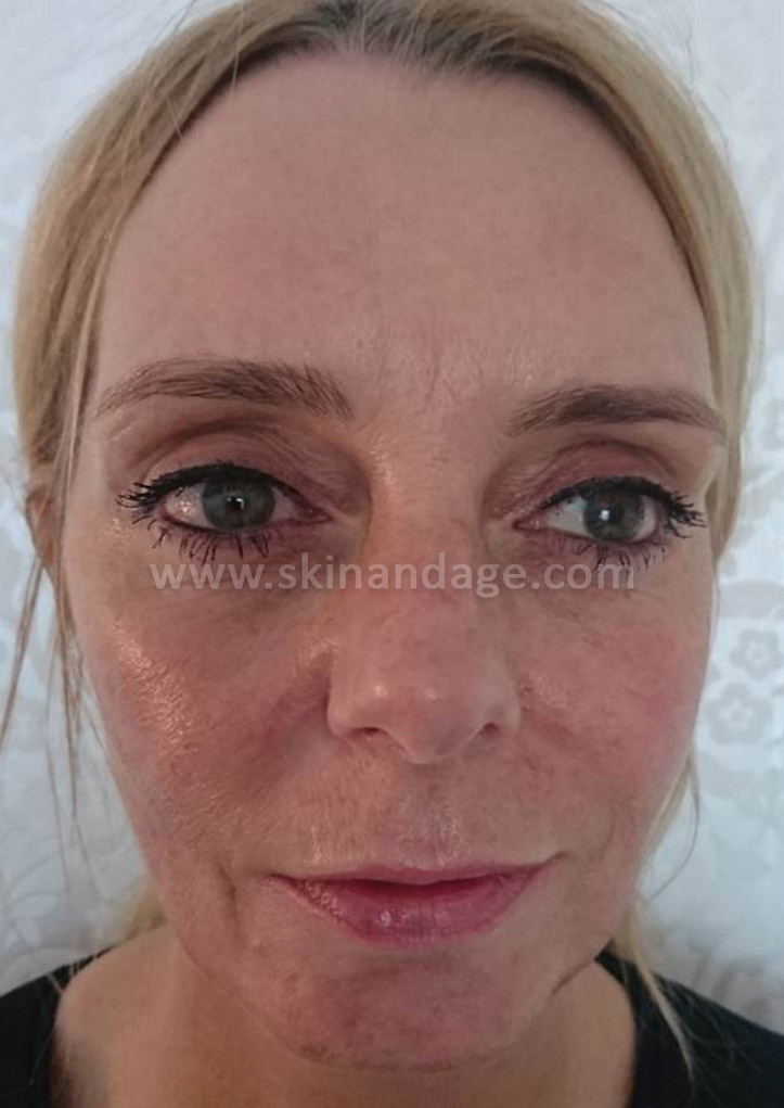 Image is not available