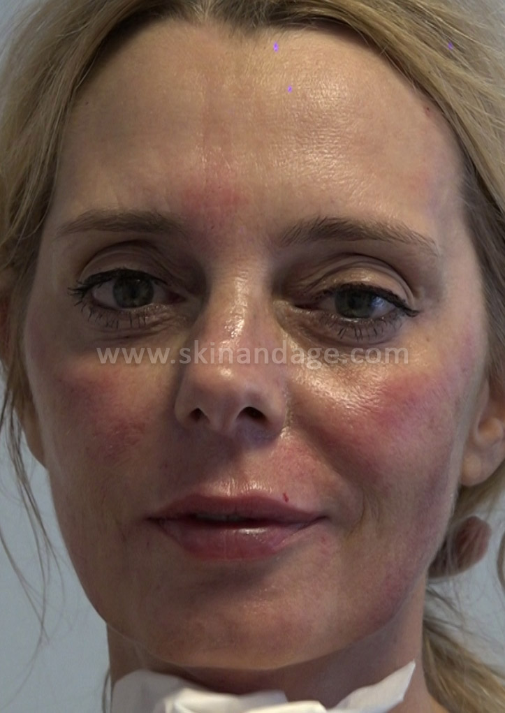 Image is not available